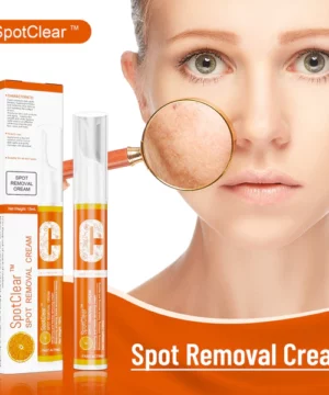 SpotClear™ Spot Removal Cream