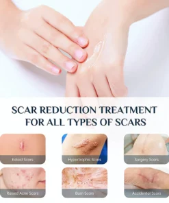 SwiftServe™ An advanced scar gel