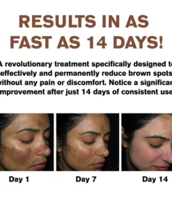 ATTDX DarkSpots SkinBrightening Serum