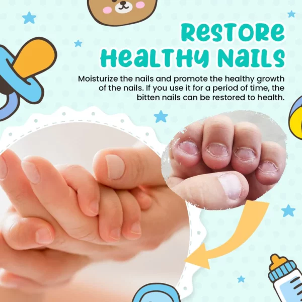 BabyBliss™ Nail Biting Treatment