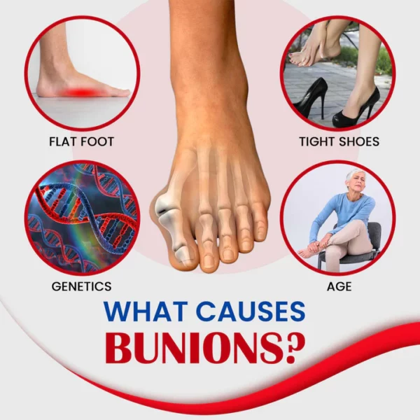 CC™ Bunion Pain Relief Cream