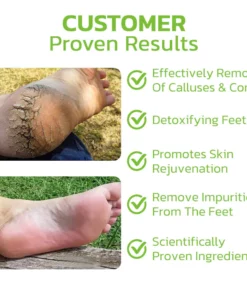 CC™ IHerbal Foot Callus And Corns Removal Soak