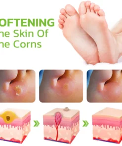 CC™ IHerbal Foot Callus And Corns Removal Soak