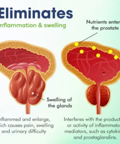 CC™ Prostate Treatment Drops