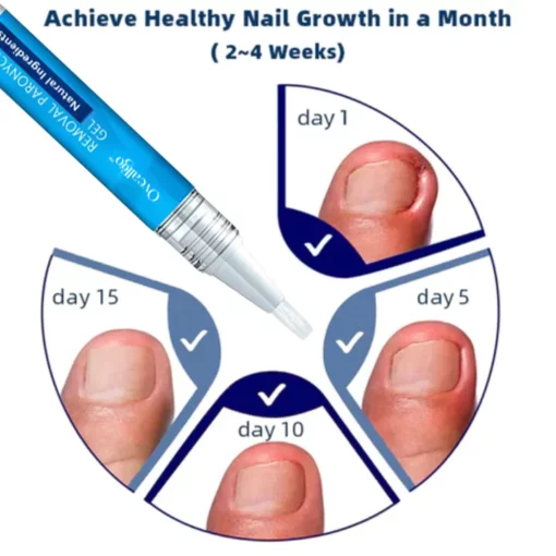 CC™ Removal Paronychia Gel - Image 7