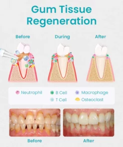 Ceoerty™ Gum Shield Therapy Gel