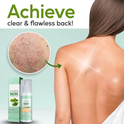 ClearSkin™ Bacne Treatment Spray - Image 3