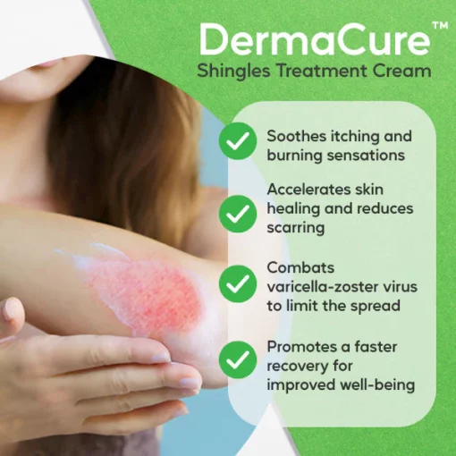 DermaCure™ Shingles Treatment Cream