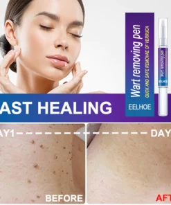 EELHOE ™ Skin Tag Remover