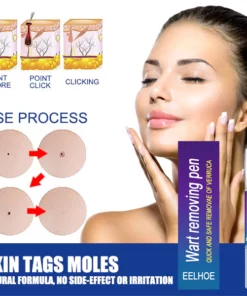 EELHOE ™ Skin Tag Remover