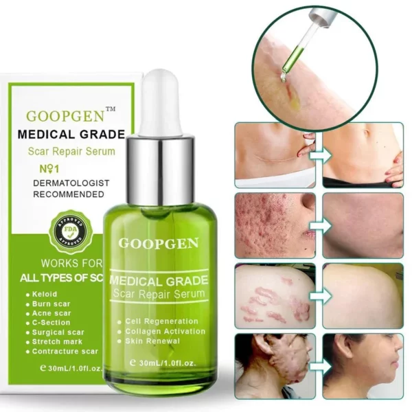 ADVANCED SCAR REPAIR SERUM FOR ALL TYPES OF SCARS