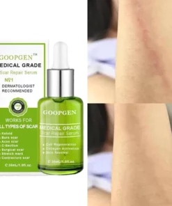 ADVANCED SCAR REPAIR SERUM FOR ALL TYPES OF SCARS