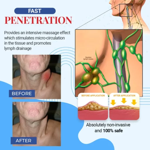 Fivfivgo™ Patches on the lymph nodes of the thyroid gland - Image 3