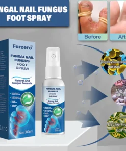 Furzero™ Medical grade fungal nail fungus foot spray