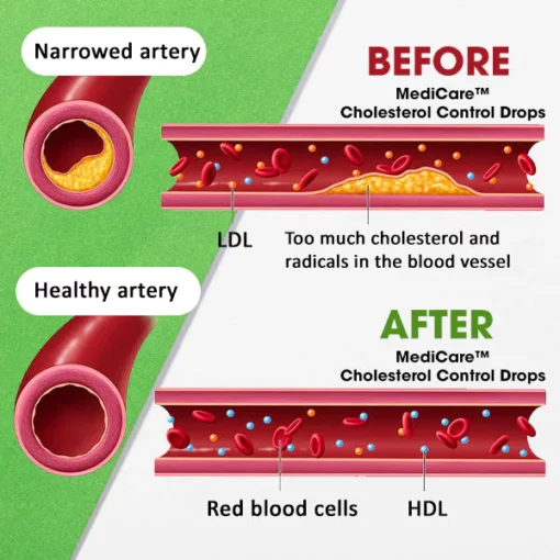 MediCare™ Cholesterol Control Drops - Image 5