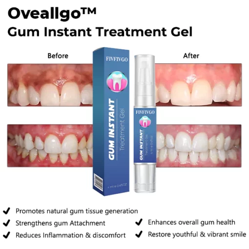 Oveallgo™ Gum Instant Treatment Gel - Image 3