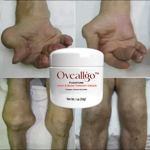 Oveallgo™ ULTRA FlexiCure Joint and Bone Therapy Cream - Image 2