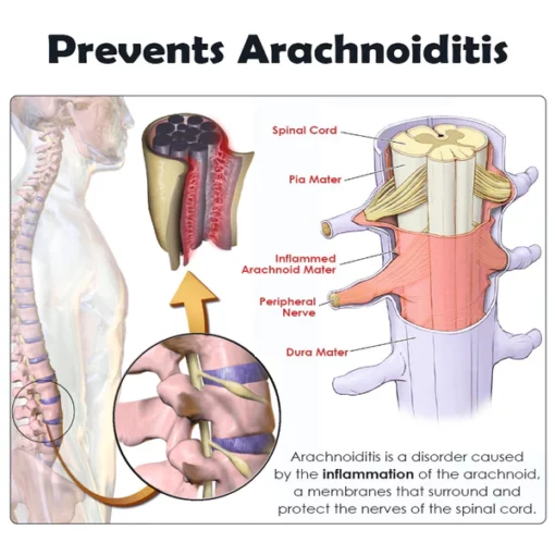 Ricpind PainRelief SciaticaTherapeutic Compression Belt