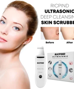 Ricpind Ultrasonic DeepCleansing Skin Scrubber