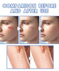 SkinRenew™ Ampoule Scar Removal Serum