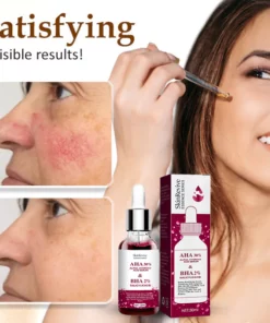 SkinRevive™ Rosacea Cure Serum