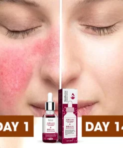 SkinRevive™ Rosacea Cure Serum