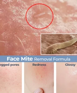 Skinetic™ Amino Acid Mite Removal Facial Cleanser