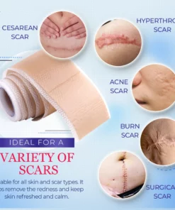 Ultracare™Medical Grade Silicone Scar Sheets