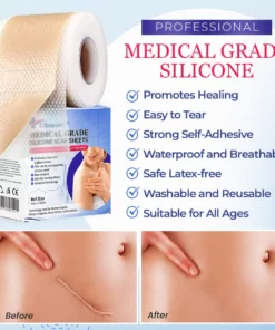 Ultracare™Medical Grade Silicone Scar Sheets