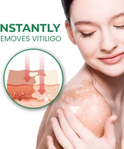 VitiligoFix Revitalize Elixir