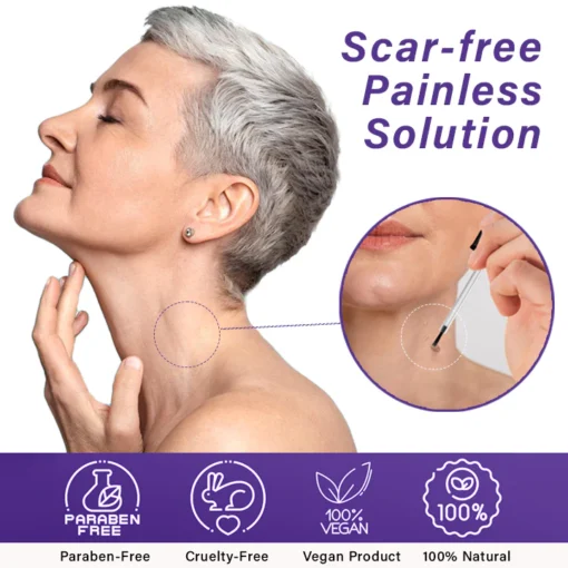 AQA™ AraneaCare Skin Tag Remover