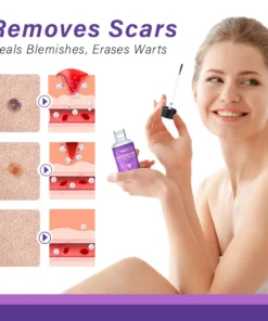 AQA™ AraneaCare Skin Tag Remover