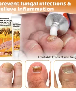 AQA™ New Zealand Bee Venom Psoriasis Treatment Cream(Suitable for all skin conditions)