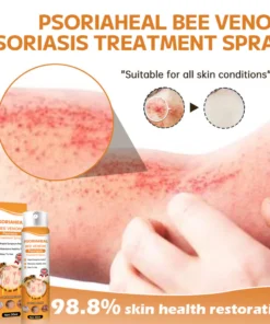 AQA™ PsoriaHeal Bee Venom Psoriasis Treatment Spray