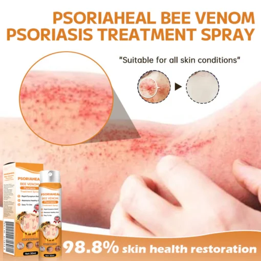 AQA™ PsoriaHeal Bee Venom Psoriasis Treatment Spray