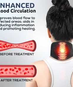 Acuplex™ Joint Relief Acupressure Belt