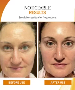 BRAZILIAN Total Revitalizer