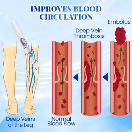 Biancat™ Blue Light Therapy Set for Varicose Veins