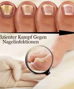 Biancat™ FungiMax Nagel Kräuter-Antipilz-Lösung