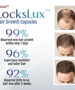 Biancat™ LocksLux Hair Growth Capsules