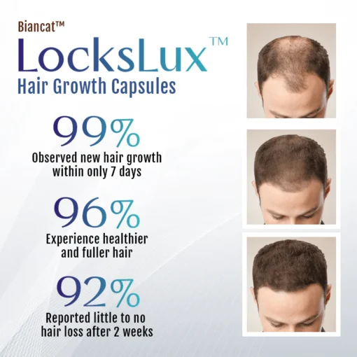 Biancat™ LocksLux Hair Growth Capsules