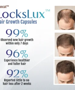 Biancat™ LocksLux™ Hair Growth Capsules