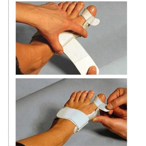 Bunion Corrector - Image 3