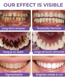 CC™ Deluxe Herbal Teeth Whitening Mousse