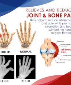 CC™ Joint & Bone Therapy Gel