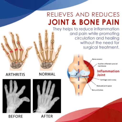 CC™ Joint & Bone Therapy Gel