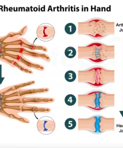 CC™ Joint & Bone Therapy Gel