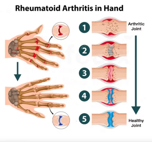 CC™ Joint & Bone Therapy Gel