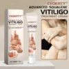 Ceoerty™ Advanced Squalene Vitiligo Treatment Cream