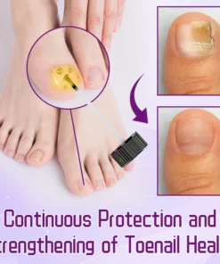 Ceoerty™ FungiShield Bee Venom Toenail Serum